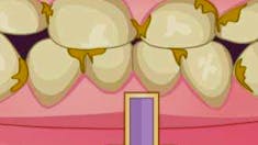 Bad Teeth Makeover